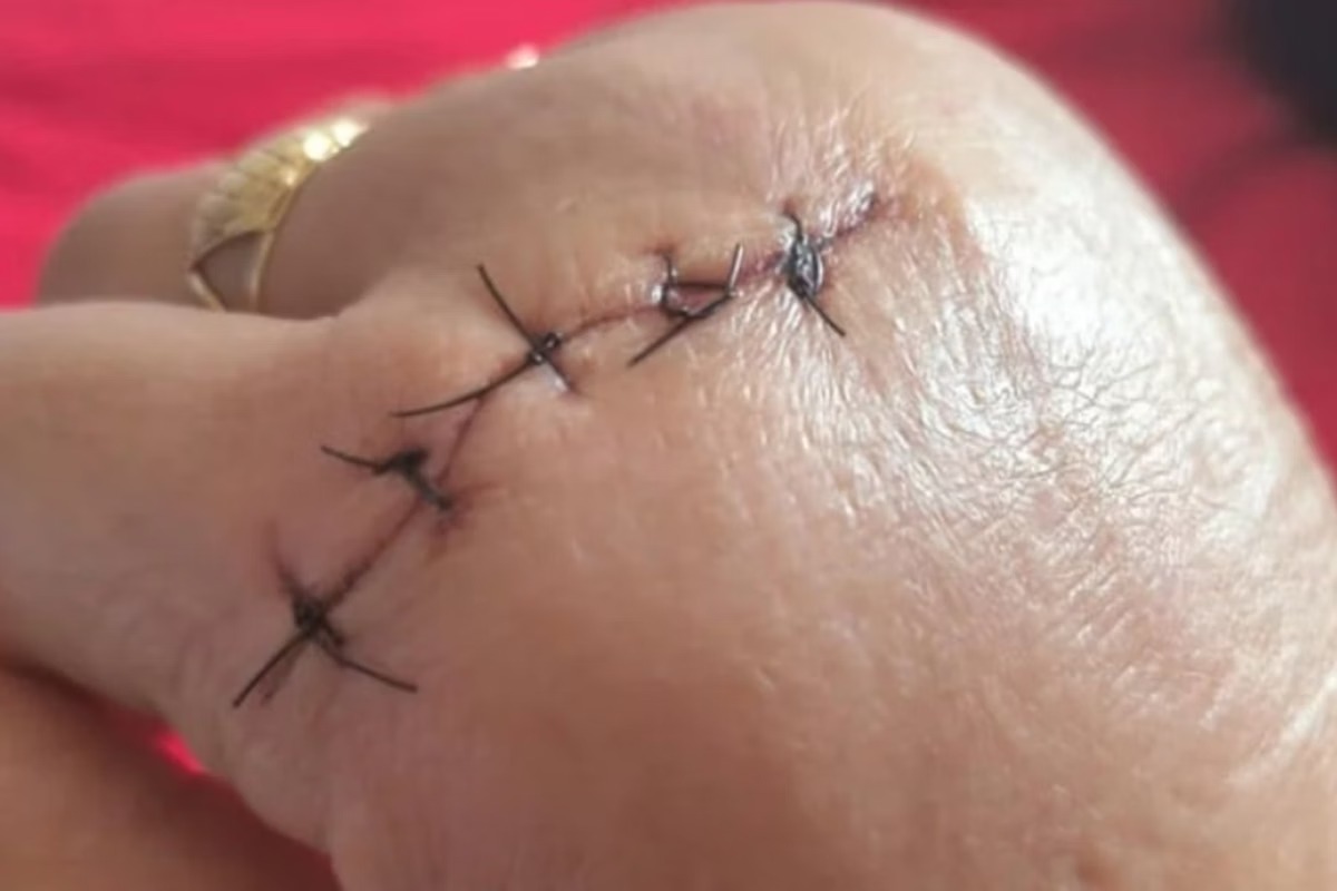 Professora sofreu golpes de faca - 