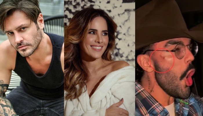 (Dado Dolabella fala sobre término com Wanessa e nega agressõe)