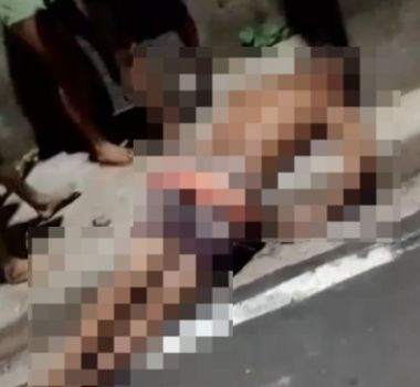 Imagem - Motociclista fica ferido após colidir com poste de energia elétrica na Grande Belém