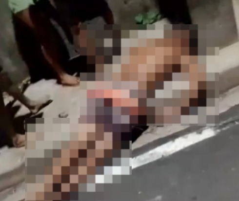 Imagem - Motociclista fica ferido após colidir com poste de energia elétrica na Grande Belém