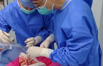 Pulmão de porco modificado geneticamente é usado em transplante humano pioneiro