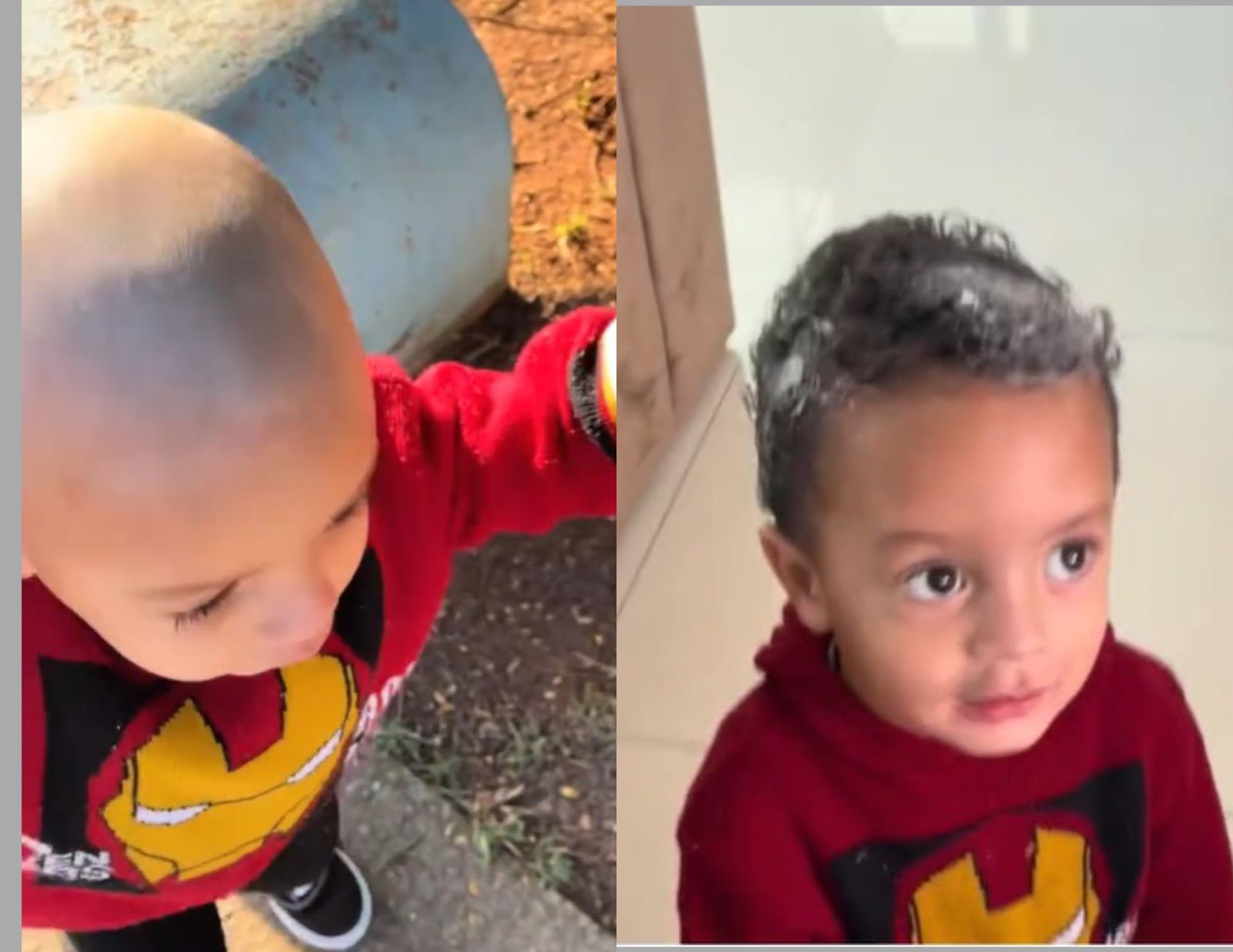 Imagem - Garotinho fica careca após usar creme depilatório na cabeça