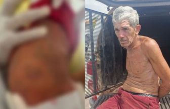 Reviravolta: exames mostram que manchas em bebê no Tauá não eram de agressão; entenda