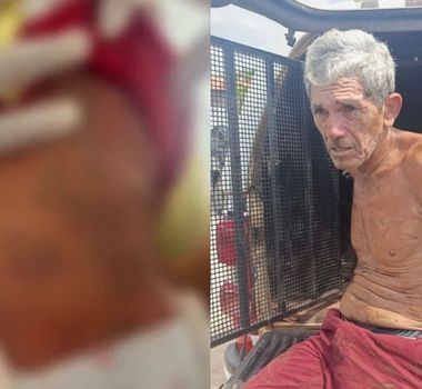 Imagem - Reviravolta: exames mostram que manchas em bebê no Tauá não eram de agressão; entenda