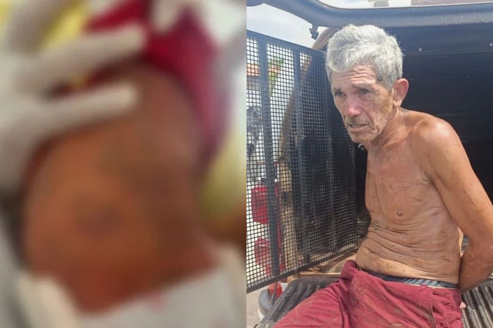 Exames mostram que manchas em bebê não eram de agressão cometida por pai.