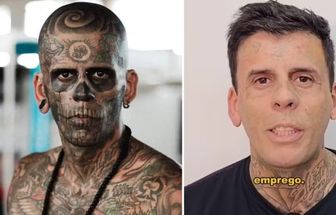 'Mais tatuado do Brasil' aparece quase irreconhecível após remoção de tatuagens no rosto