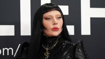Imagem - Lady Gaga cancela show em Miami minutos antes do início por problema nas cordas vocais