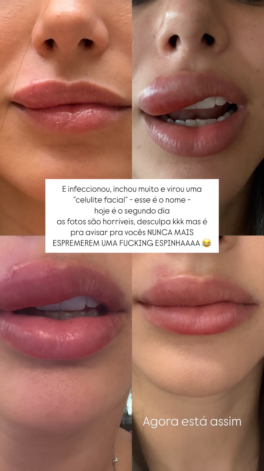 Sequência de fotos postada por Bruna.