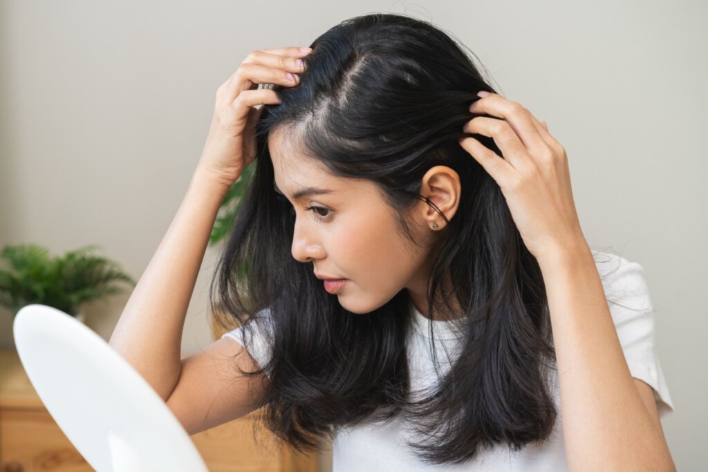 O tratamento da alopecia areata varia conforme o paciente (Imagem: Kmpzzz | Shutterstock) 