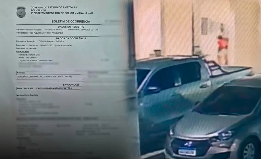 (Família acusa o agressor de provocar lesões graves na criança.)