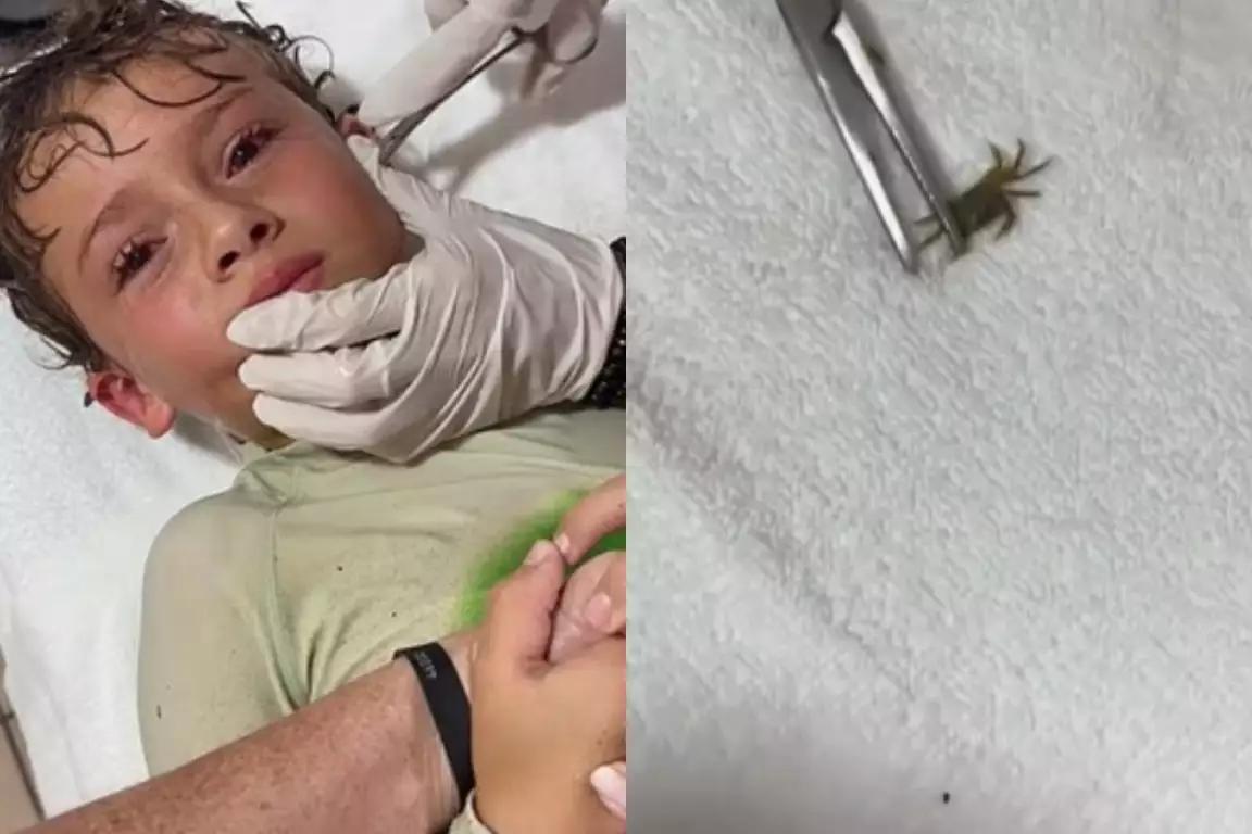 O episódio ocorreu depois que a criança sentiu movimentos estranhos na cabeça ao voltar de um dia na praia.

