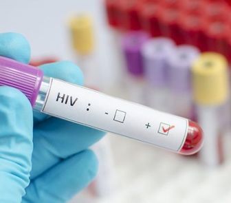 Imagem - Prefeitura na Bahia expõe nomes de centenas de pessoas com HIV no Diário Oficial