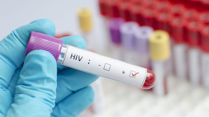 Testagem de HIV.