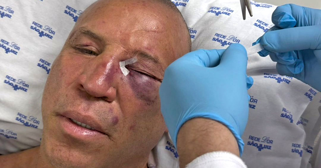 Imagem - Wanderlei Silva anuncia ação judicial após agressão de filho de Popó em luta de boxe