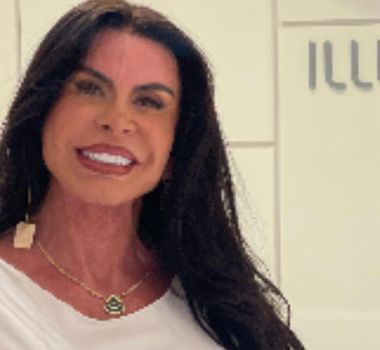 Imagem - Gretchen responde haters sobre novo procedimento estético