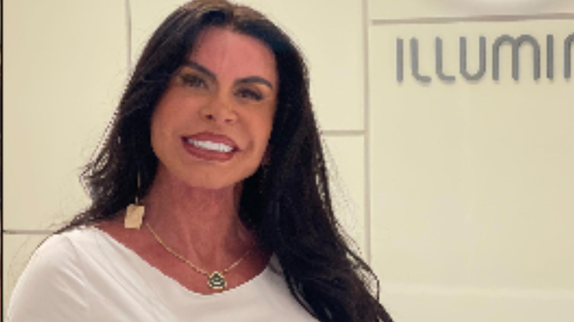 Gretchen mostra autoestima diante das críticas sobre novo procedimento