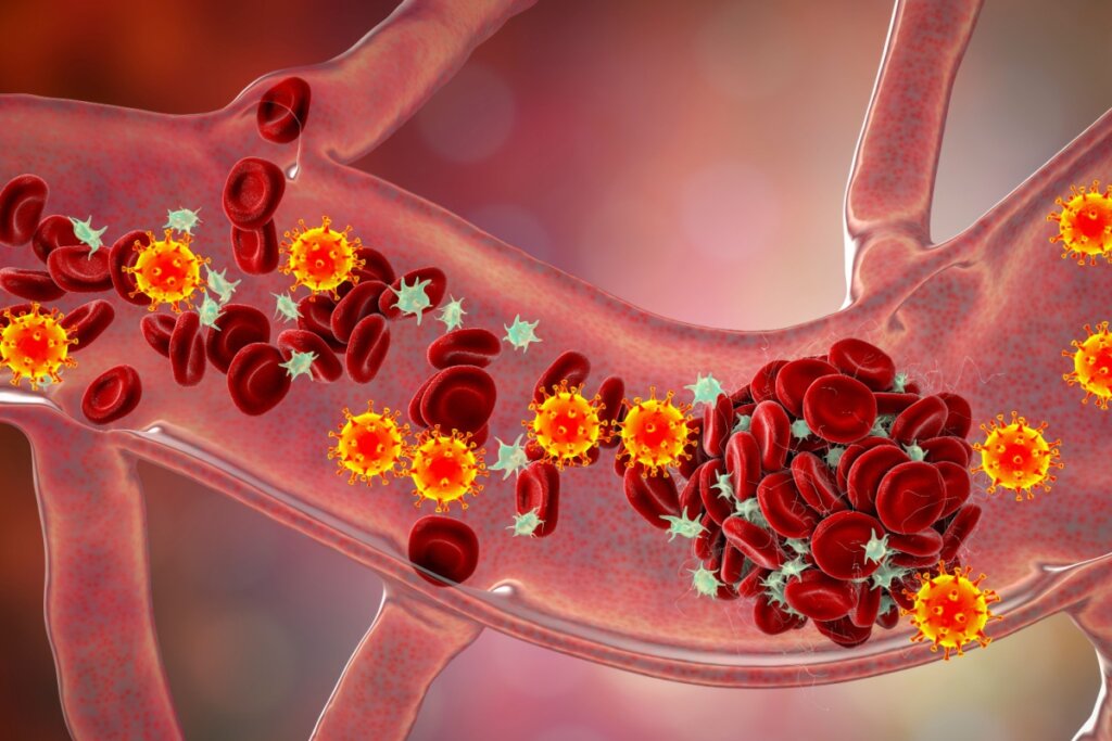 A trombofilia é uma condição em que o sangue tem uma tendência aumentada de formar coágulos (Imagem: Kateryna Kon | Shutterstock) 