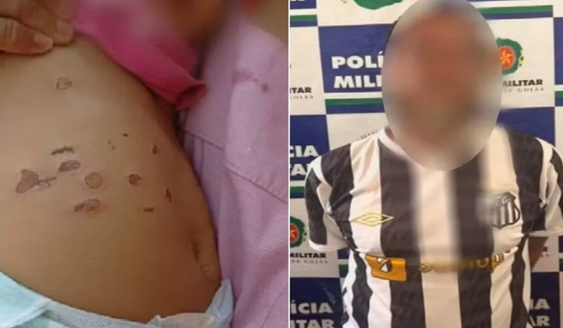 (Após depoimento da mãe, os policiais iniciaram buscas pelo companheiro dela, apontado como principal suspeito das agressões e da tortura contra a criança.)
