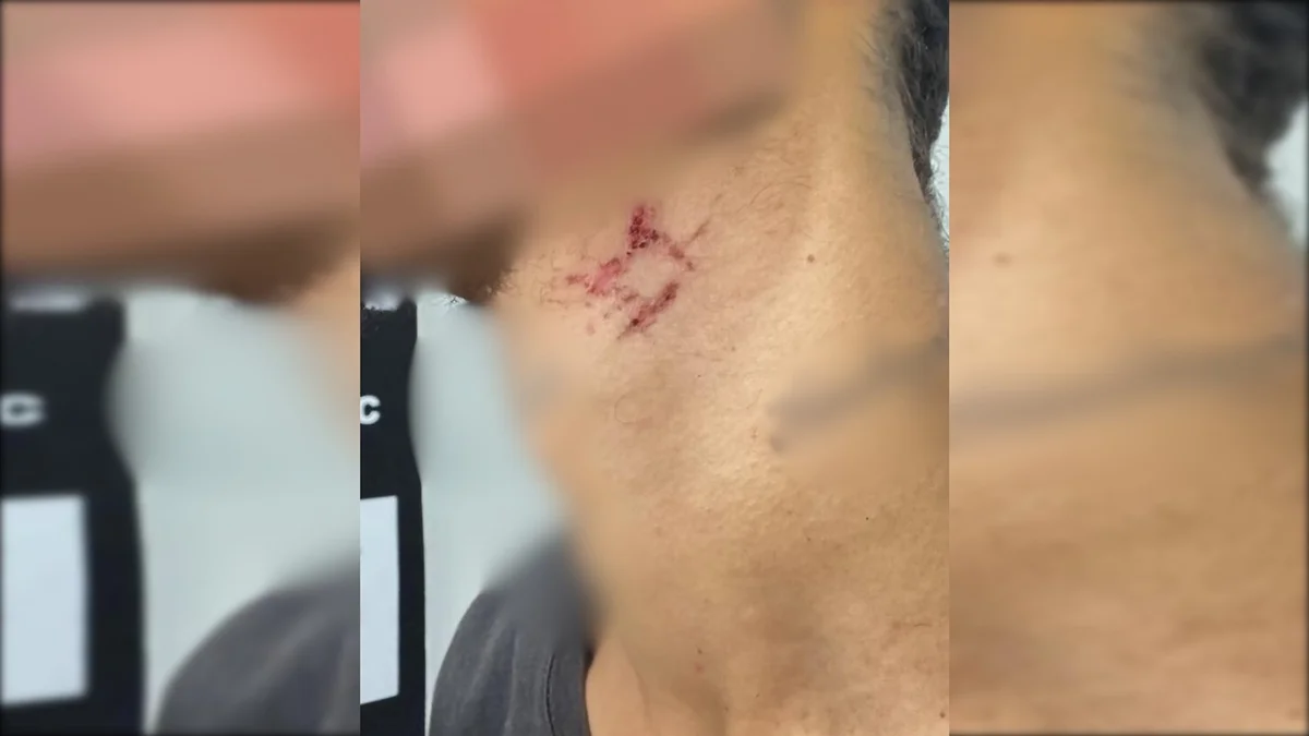 Imagem - Jovem é resgatado após passar um ano em cárcere e submetido a estupros em Goiânia