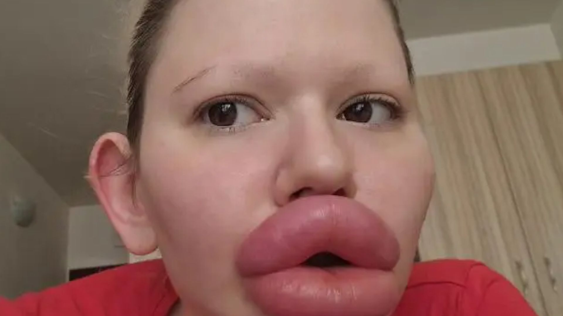 Mulher afirma que não vai parar com procedimentos, embora com riscos a saúde