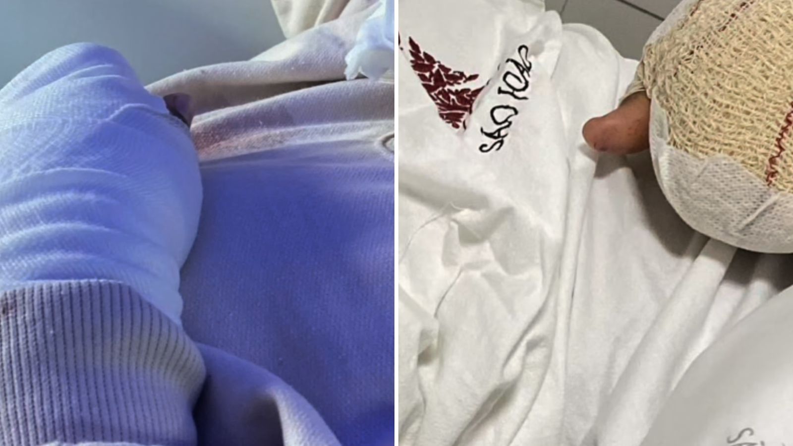 Brasileiro de 9 anos tem dedos decepados por outros alunos em escola de Portugal - 