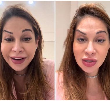 Imagem - Maíra Cardi exibe rosto deformado após botox dar errado: 'Olha que palhaçada'