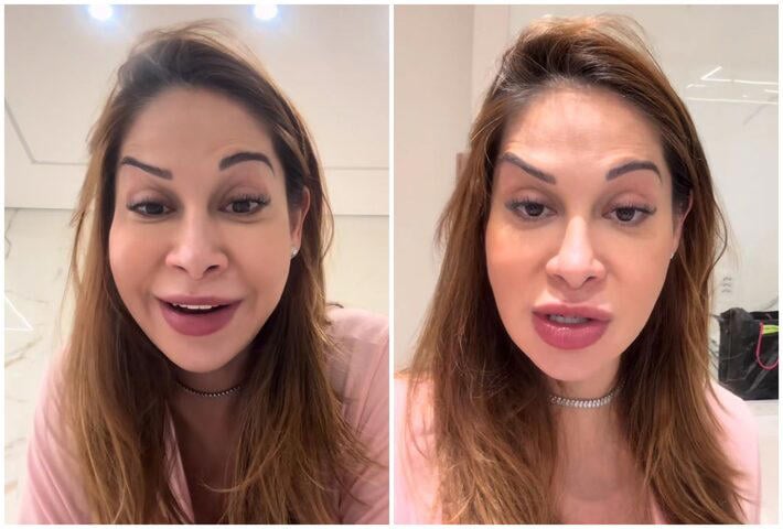Imagem - Maíra Cardi exibe rosto deformado após botox dar errado: 'Olha que palhaçada'