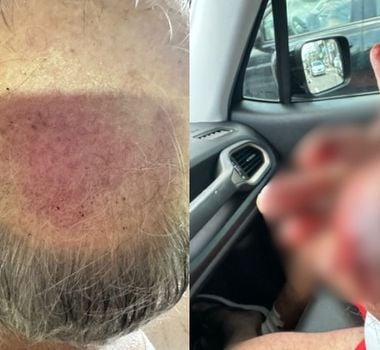 Imagem - Idoso é agredido por batedor da PM na saída da Agrizone, em Belém