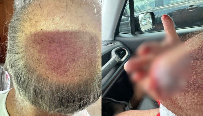 Imagem - Idoso é agredido por batedor da PM na saída da Agrizone, em Belém