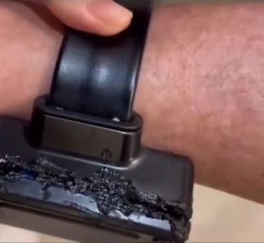 Imagem - Vídeo: Bolsonaro confessa uso de ferro de solda em tornozeleira: 'curiosidade'