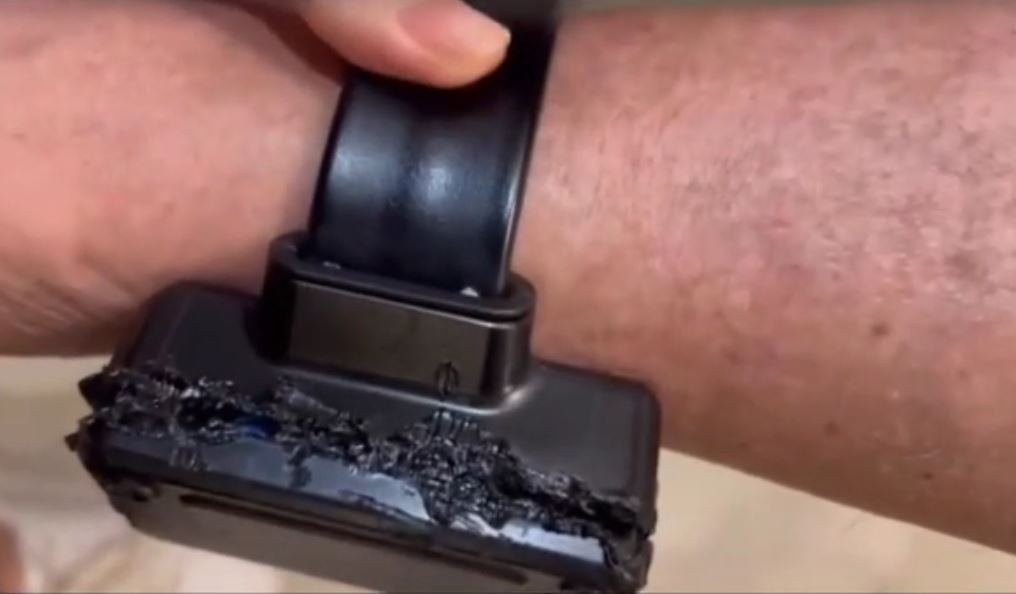 Imagem - Vídeo: Bolsonaro confessa uso de ferro de solda em tornozeleira: 'curiosidade'