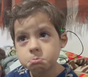 Imagem - Menino de três anos ouve pela primeira vez após cirurgia; assista