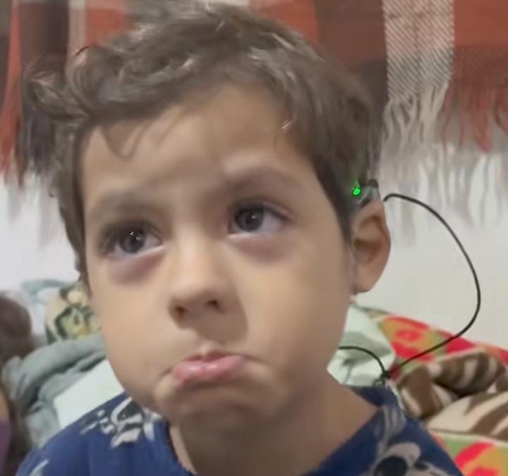 Imagem - Menino de três anos ouve pela primeira vez após cirurgia; assista