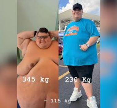 Imagem - Transformação de Gordão da XJ: Antes e Depois Impressiona com Perda de 115 kg