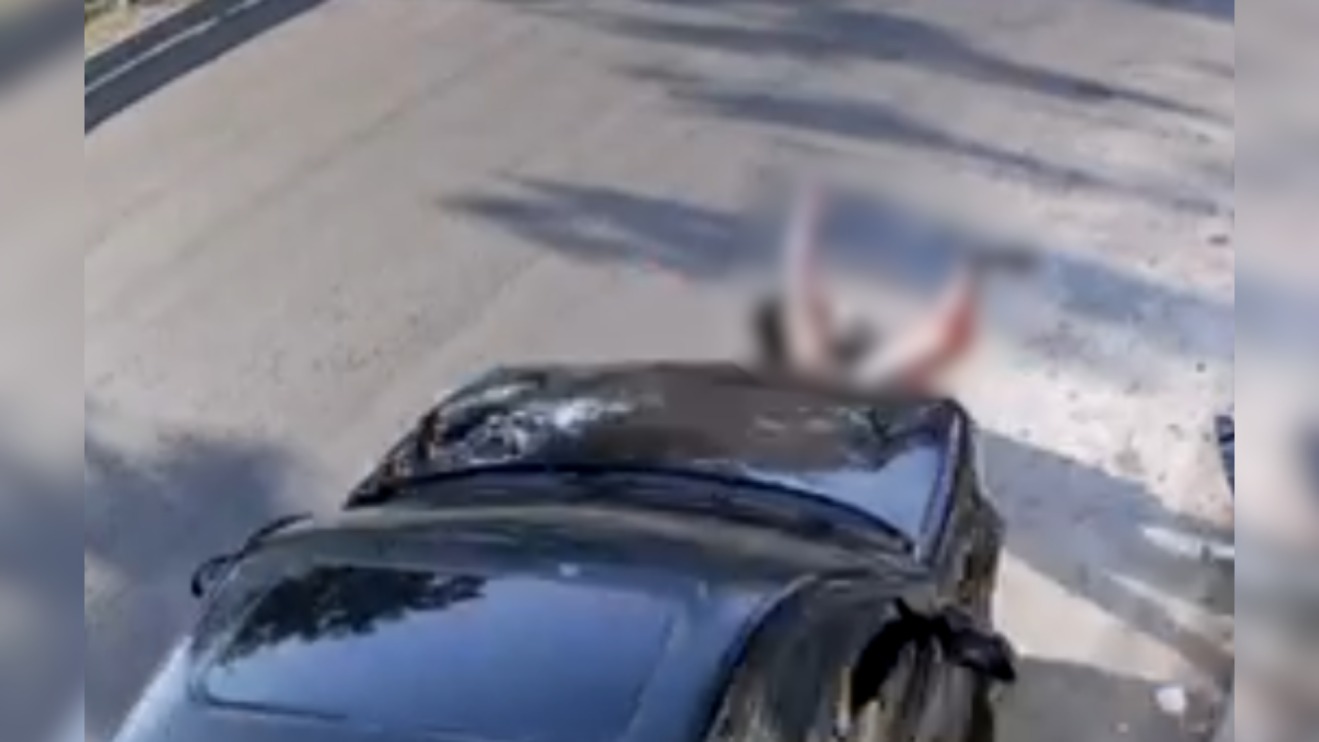 Ela está reagindo bem e não há previsão para as próximas cirurgias; informação foi confirmada nesta quinta-feira (4)