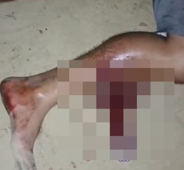 Imagem - Homem é baleado na perna após agredir policiais durante abordagem em Augusto Corrêa