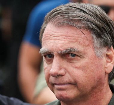 Imagem - Perícia da PF aponta que Bolsonaro precisa de cirurgia para tratar hérnia