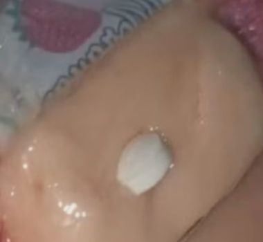 Imagem - Criança passa mal após comer doce entregue por ‘Papai Noel’ em Minas Gerais