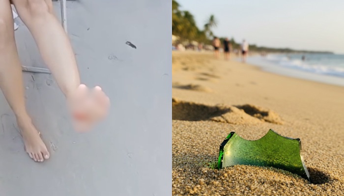 Imagem - Vídeo: homem denuncia descarte ilegal de lixo após criança cortar o pé na praia do Atalaia