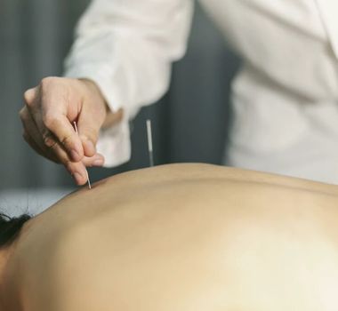 Imagem - Brasil oficializa exercício profissional da acupuntura