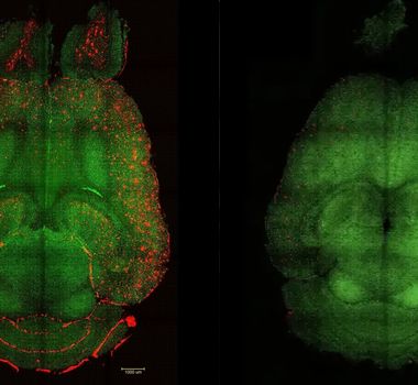 Imagem - Nanotecnologia se mostra eficaz no tratamento do Alzheimer, dizem pesquisadores