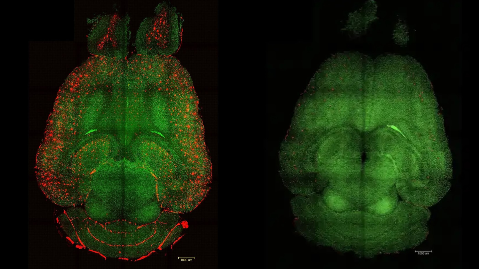 Imagem - Nanotecnologia se mostra eficaz no tratamento do Alzheimer, dizem pesquisadores