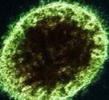 Imagem - Vírus Nipah: como é transmitido? Pode chegar ao Brasil? Quais os sintomas? Tire dúvidas