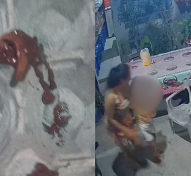 Imagem - Criança passa mal após encontrar lesma em açaí consumido em Mosqueiro