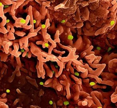 Imagem - Saiba sobre os três vírus que podem desencadear novas crises em 2026