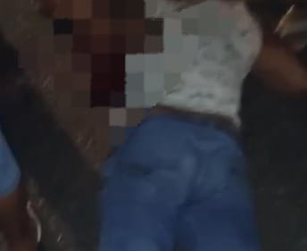 (Com o impacto, o ciclista foi arremessado para o outro lado da pista e sofreu lesões graves no rosto, com intensa perda de sangue.)