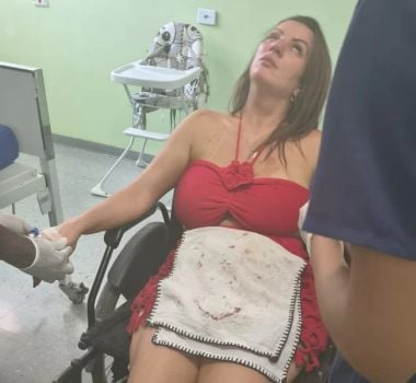 Imagem - Namorado socou e chutou rosto de vereadora antes de ser atropelado