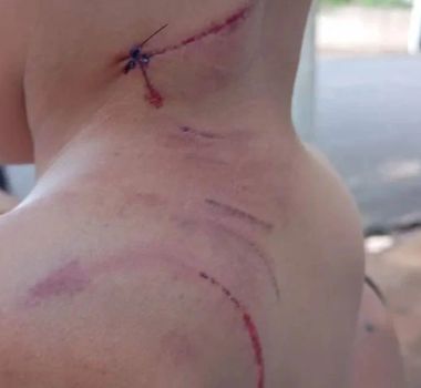 Imagem - Criança de 3 anos e mãe são atacadas por labrador após animal fugir de casa em Araçatuba