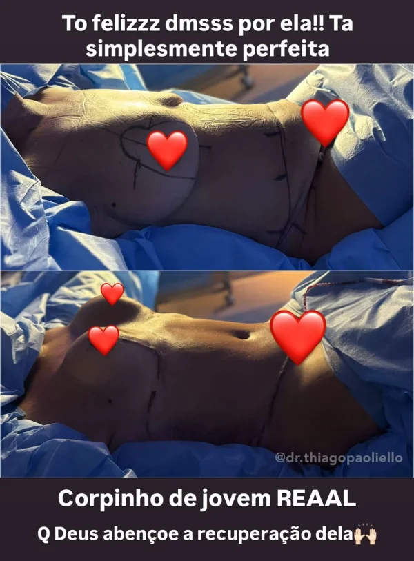 antes e depois do corpo de Margareth