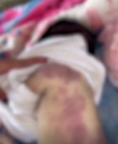 (Criança de dois meses encontrada morta)